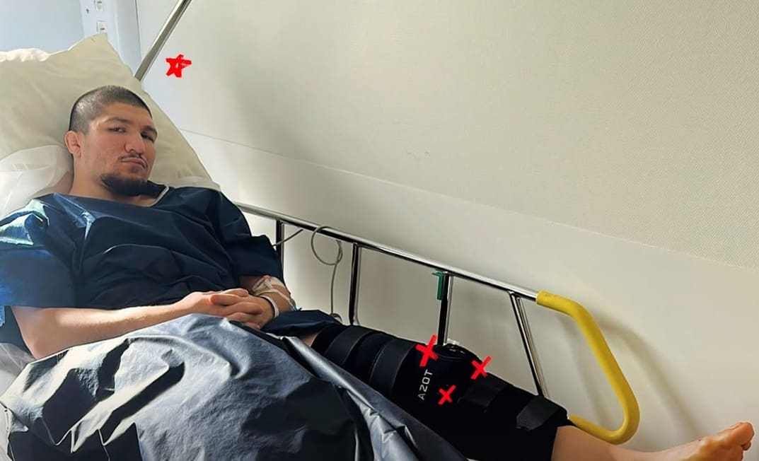 You are currently viewing MMA : Baki rassure ses fans après son opération du genou, objectif retour à 100 %