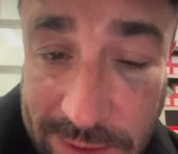 You are currently viewing Val d’Oise : Anthony Joubert agressé dans un TER avant un spectacle