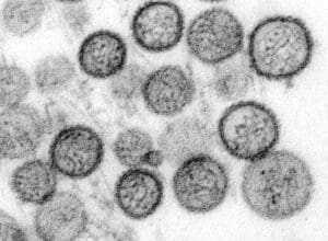 Lire la suite à propos de l’article Séquençage du hantavirus Andes : aucune mutation préoccupante détectée selon l’OMS