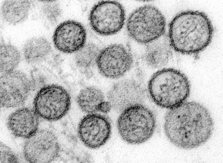 Lire la suite à propos de l’article Séquençage du hantavirus Andes : aucune mutation préoccupante détectée selon l’OMS