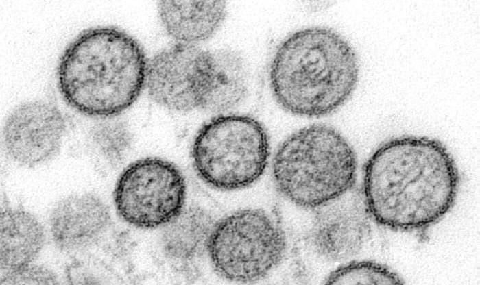hantavirus. Photo : @Lex
