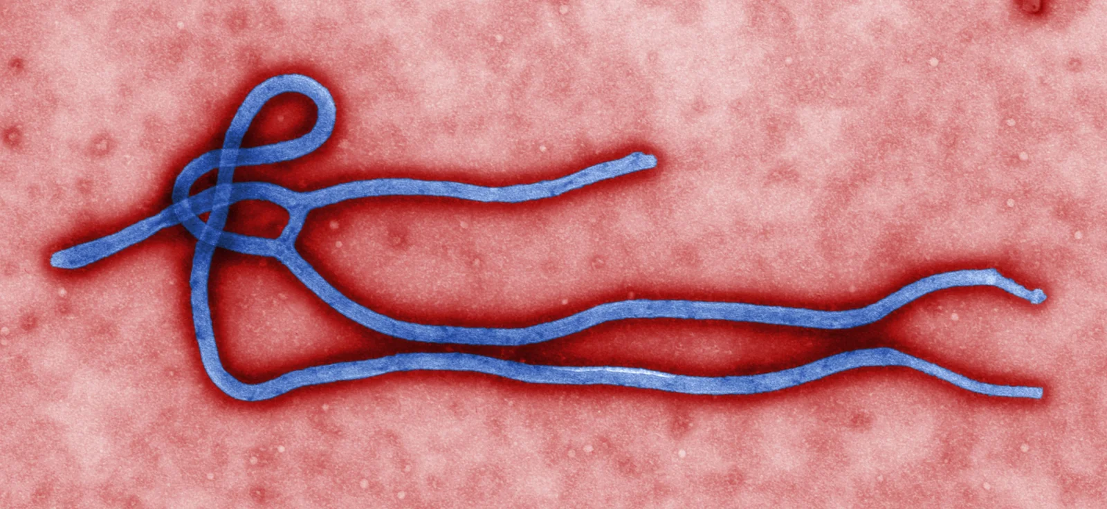 Virion du virus Ebola