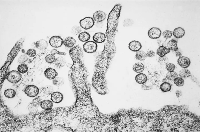 Lire la suite à propos de l’article Hantavirus en France : comment le système sanitaire prépare le rapatriement des passagers