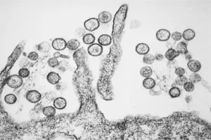 Lire la suite à propos de l’article Hantavirus : trois adolescents d’une même fratrie parmi les cas contacts français